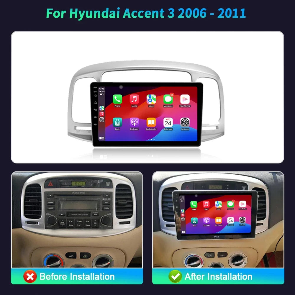9 inch Car Radio For Hyundai Accent 3 2006-2011 BT Carplay Android 16 Multimedia Navigatio