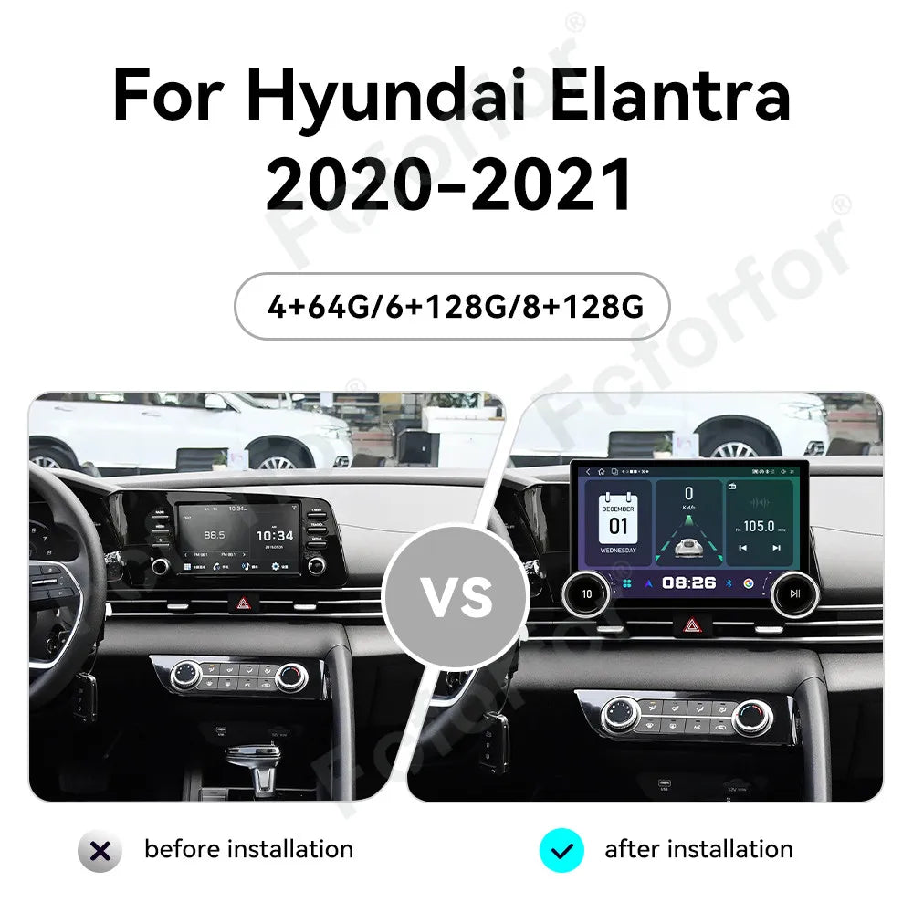Large Screen Smart Stereo 11.5 Inch Android 15 HD Touch CarPlay Android Auto GPS Multimedi