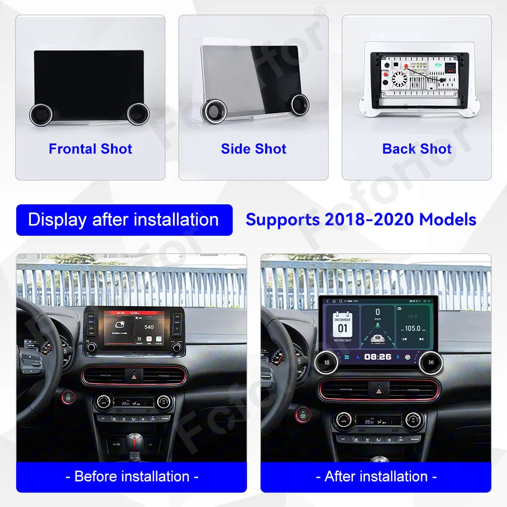 Premium Pro 11.5 Inch Full HD Touch Screen Android 15 Wireless CarPlay GPS Navi Head Unit