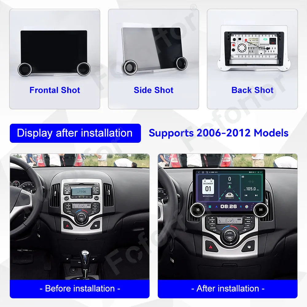 Luxury Premium Wireless CarPlay Built-in 11.5 Inch Android 15 Full HD Touch Multimedia Car