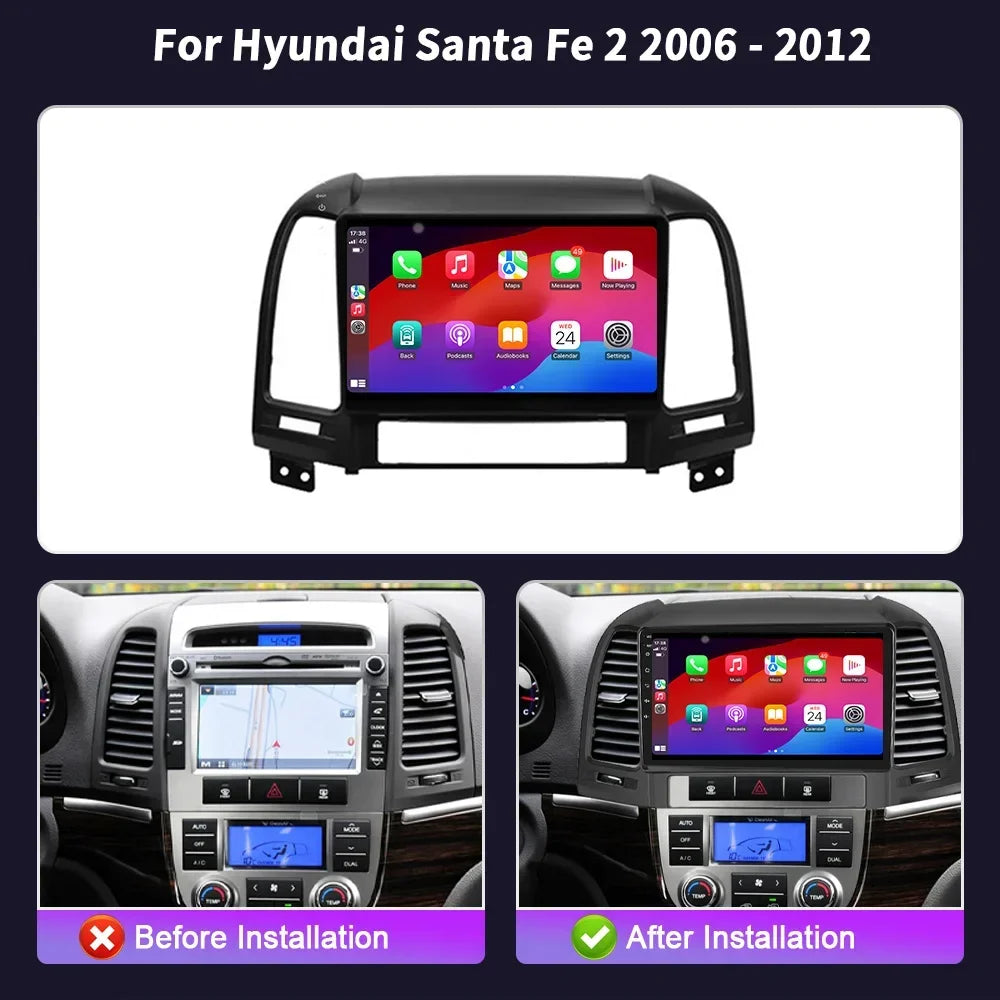 Android 14 For Hyundai SONATA NF 2004-2008 Car Radio Navigation 4G GPS Wireless Bluetooth