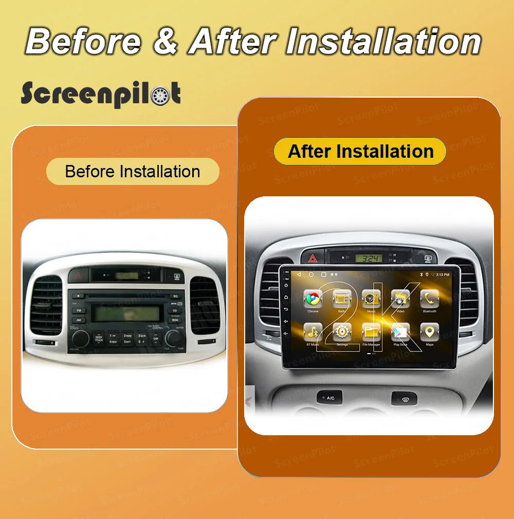 Android 16 For Hyundai Accent 3 2006 - 2011 Gps Android No 2din 2 Din Dvd Car Radio Multim | AUTOKITSHOP