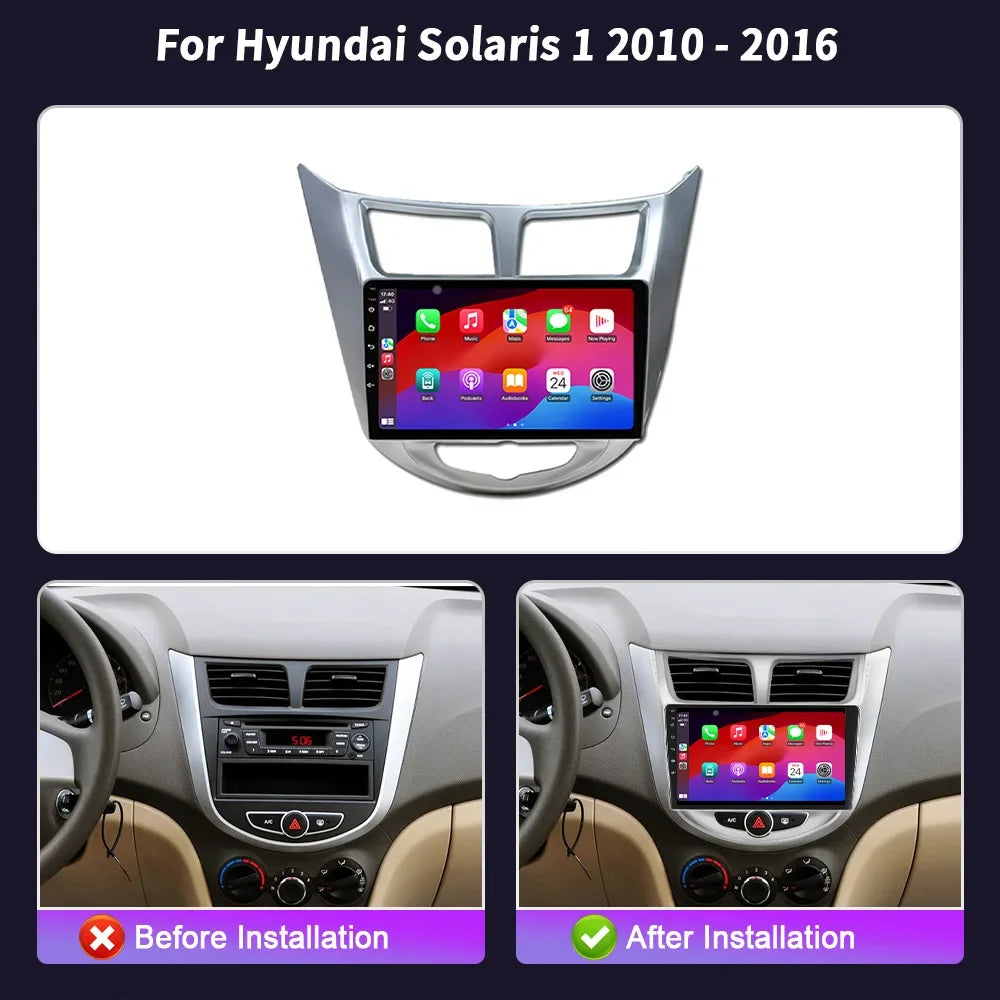 Car Radio Navigation GPS 5G WIFI Multimedia Wireless Bluetooth Carplay Stereo Screen Andro