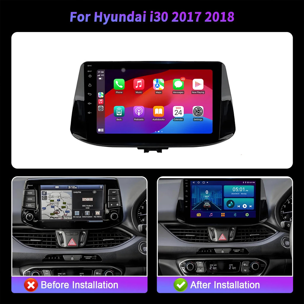 For Hyundai i30 2017 2018 Car Radio Multimedia Android 14 GPS Wireless BT CarPlay Navigati