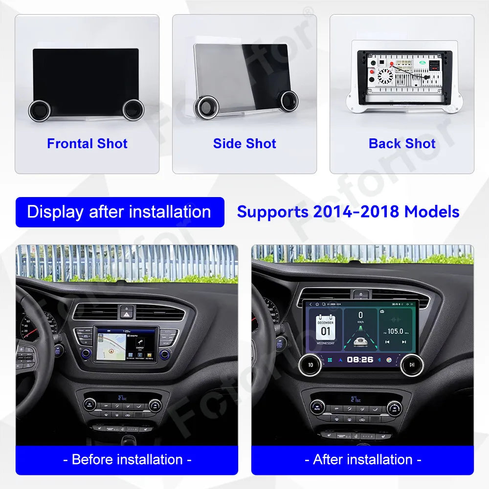Top Tier Edition Wireless CarPlay 11.5 Inch Android 15 Full HD Touch Multimedia Car Radio