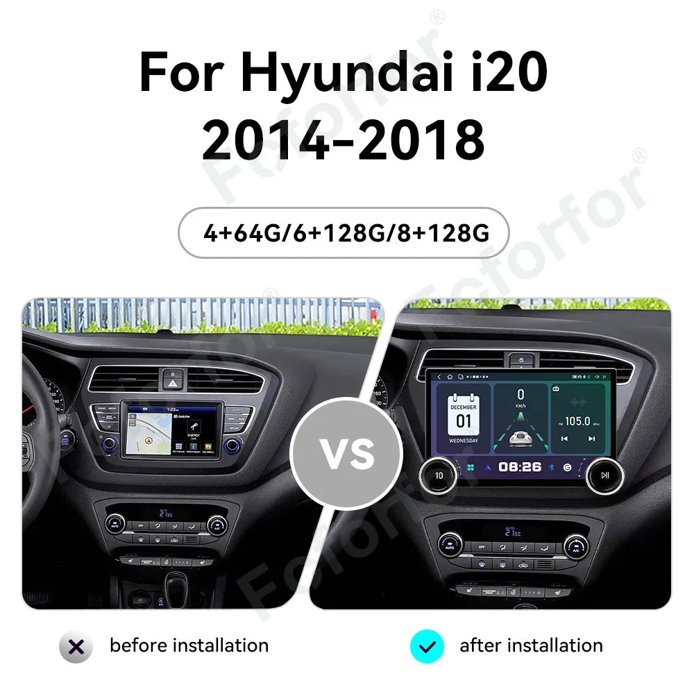 Top Tier Edition Wireless CarPlay 11.5 Inch Android 15 Full HD Touch Multimedia Car Radio