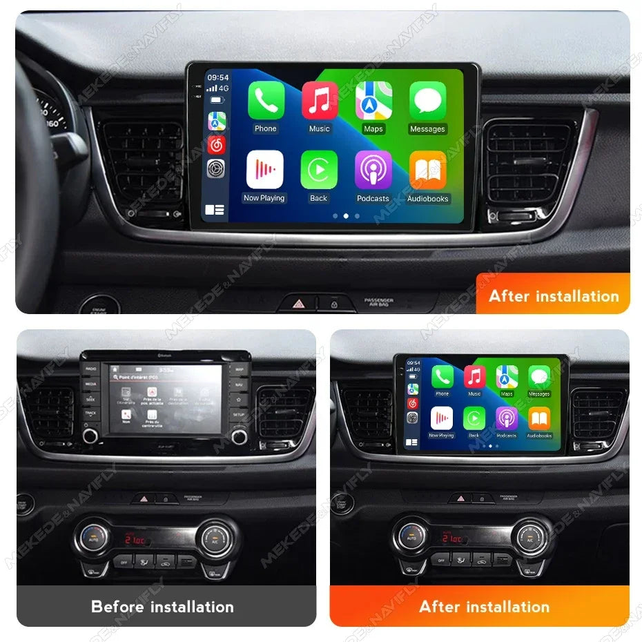 Android Car Radio FM Stereo for Kia RIO Stonic 2017 2018 2019 2020 2021 2022 CarPlay Auto  | AUTOKITSHOP