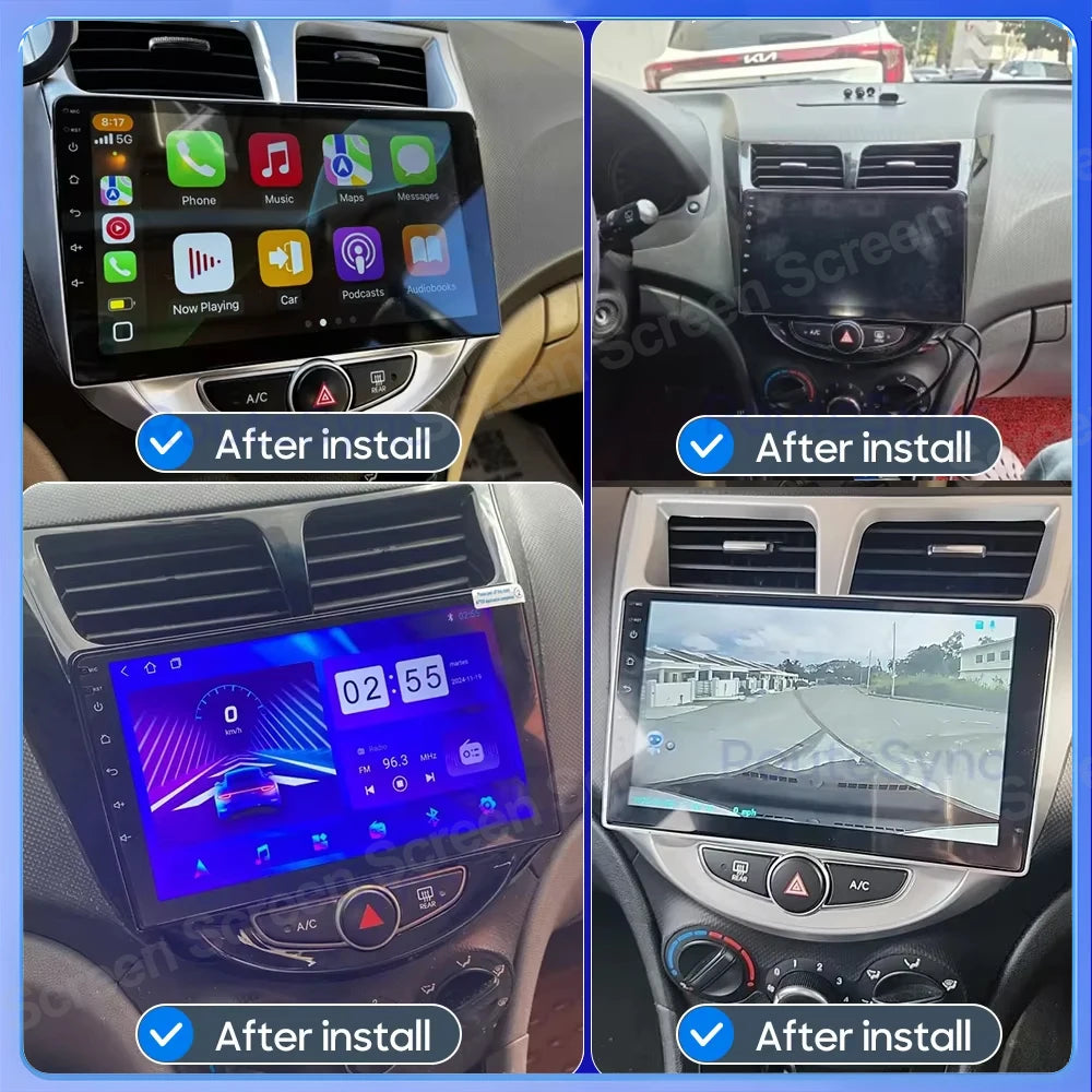 Android 16 Dsp Car Radio For Hyundai Solaris Verna Accent 1 2010 - 2016 Multimedia Player  | AUTOKITSHOP