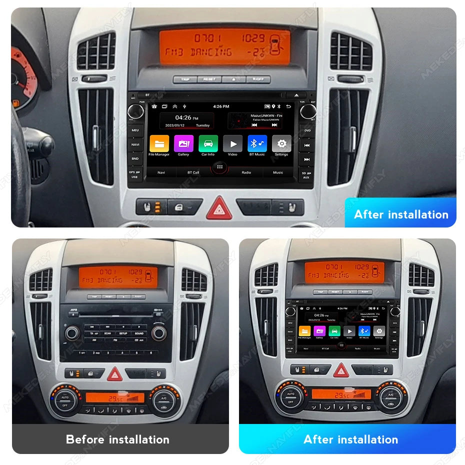 For Kia Ceed Venga 2010-2016 Android 15 64G 2 Din 7inch Car Radio Carplay Central Multimed