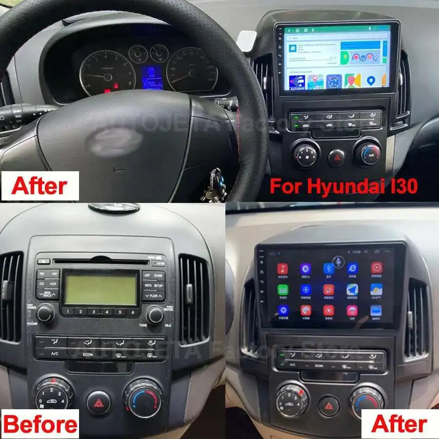 Canbus Carplay Car Radio Android 15 For Hyundai I30 2006-2011 Auto Stereo Navigation Multi