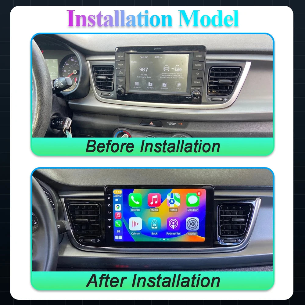 Android 16 Carplay Auto Car Radio For Kia Rio Stonic Yb 2016 2017 2018 2019 2020 2021 2022 | AUTOKITSHOP