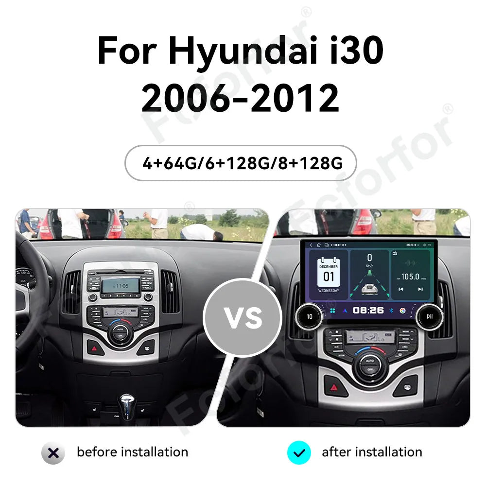 Luxury Premium Wireless CarPlay Built-in 11.5 Inch Android 15 Full HD Touch Multimedia Car