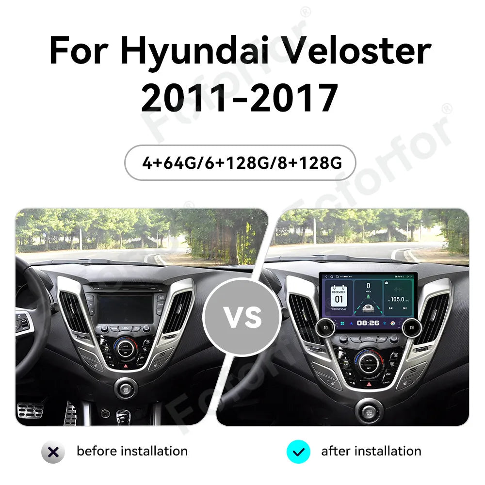 Smart Car System Android 15 11.5 Inch HD Touch Wireless CarPlay Android Auto GPS Navi Head