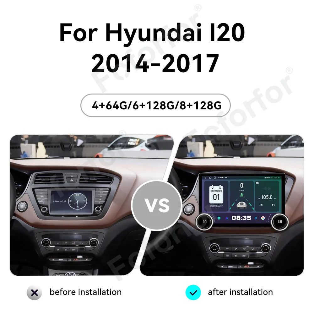 Generation 11.5 Inch Android 15 Advanced Elite Full HD Touch Wireless CarPlay GPS Navi Hea