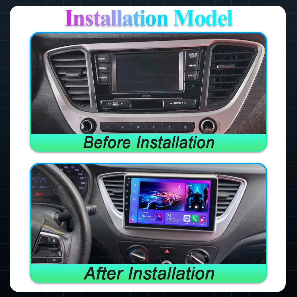 Android 16 Car Radio For Hyundai Solaris Accent 2 Ii 2017-2021 Multimedia Stereo Player Na | AUTOKITSHOP